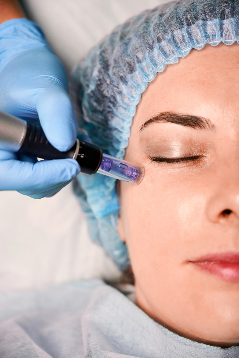 Korektivní dermatologie v Petra Clinic