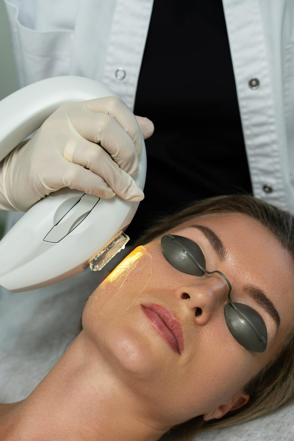 Benefits of photorejuvenation