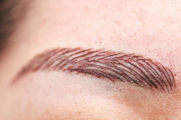 Odstranění permanentního makeupu v Petra Clinic