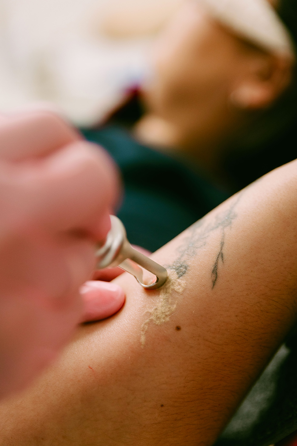 Benefits of tattoo removal